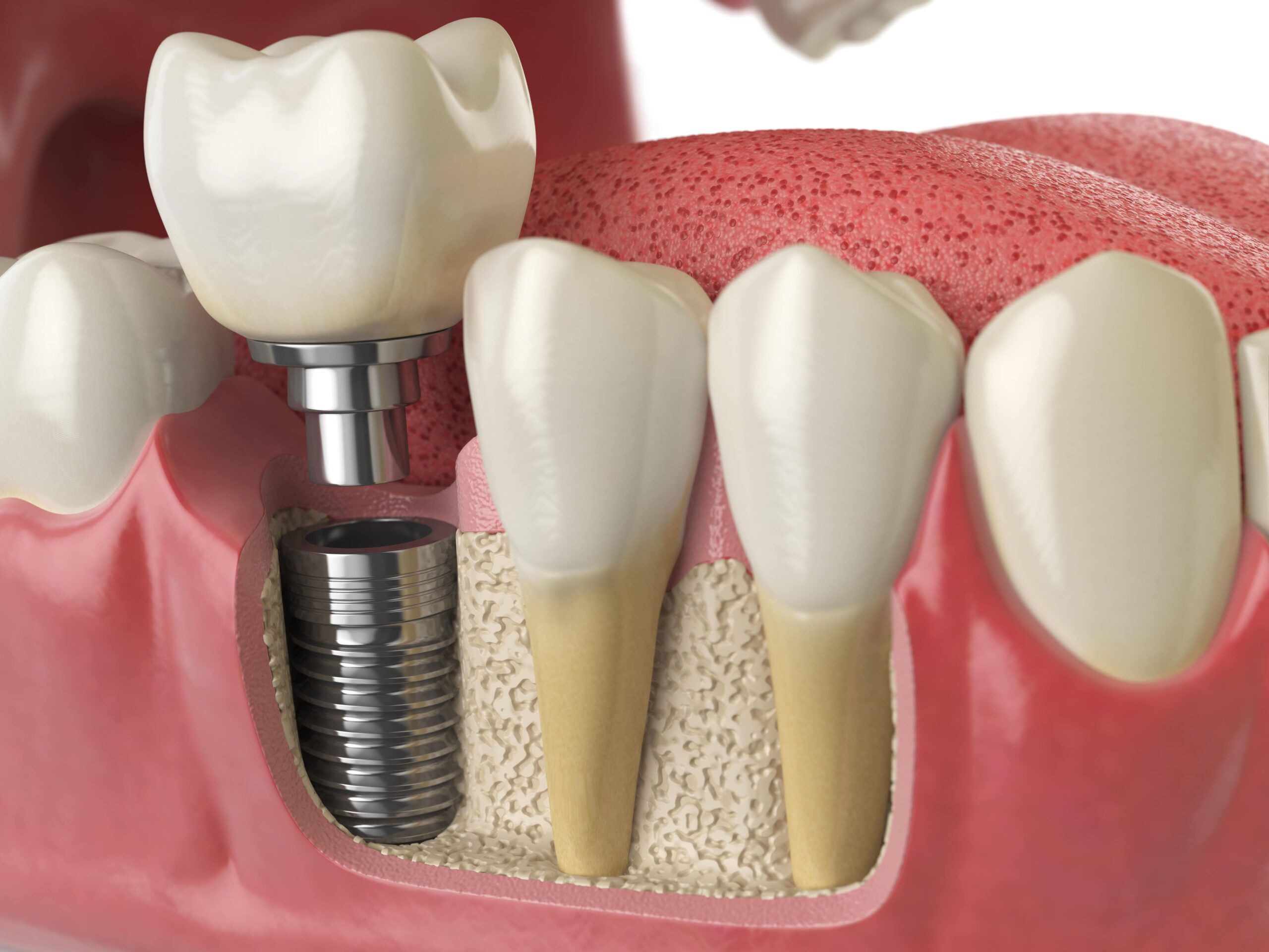 Hochmoderne Geräte und Technologien für die Implantatbehandlung in der Praxis Dentalia