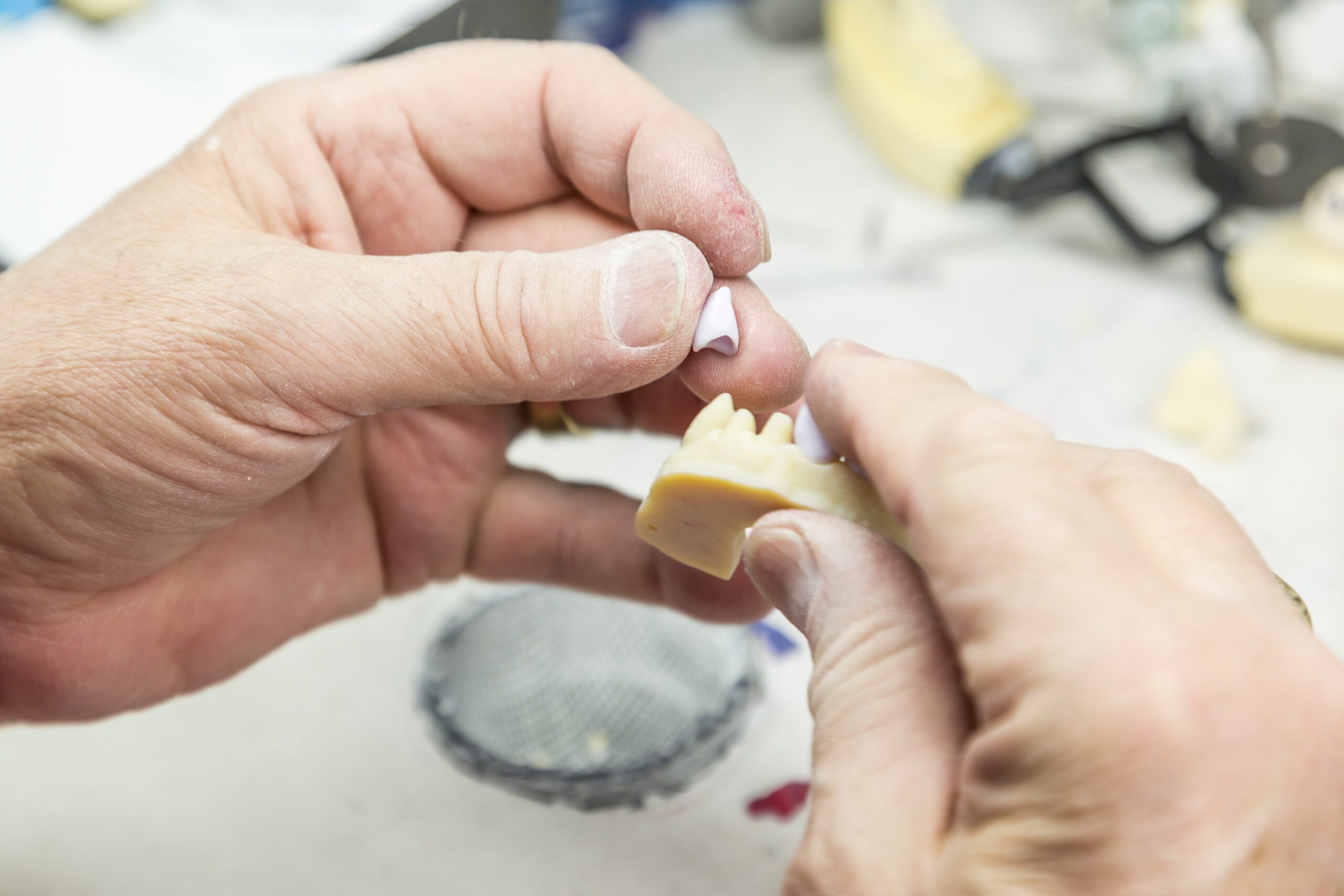 Zahnarzt passt eine Teilprothese an die Zähne eines Patienten an